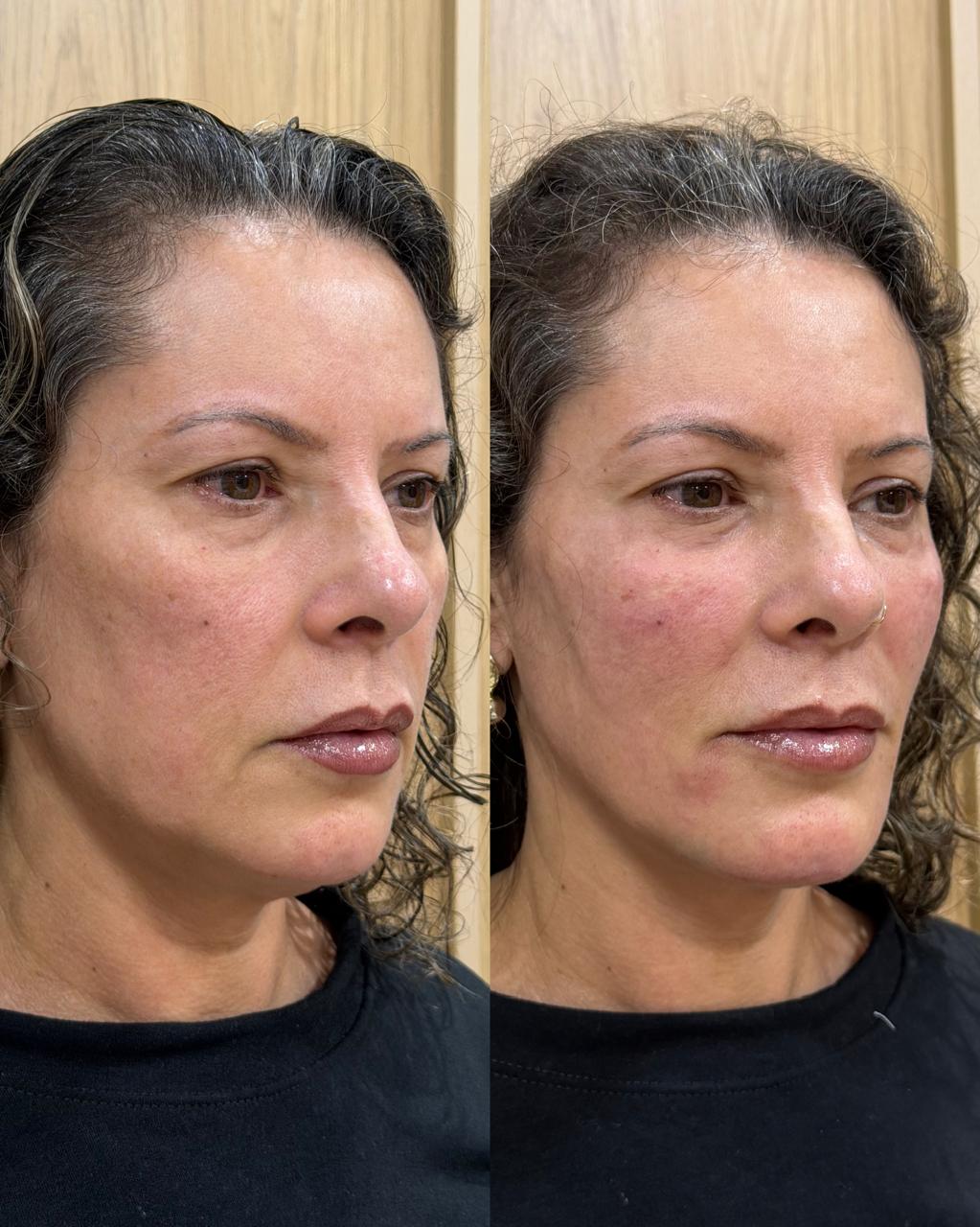 Caso selecionado em comparação antes e depois