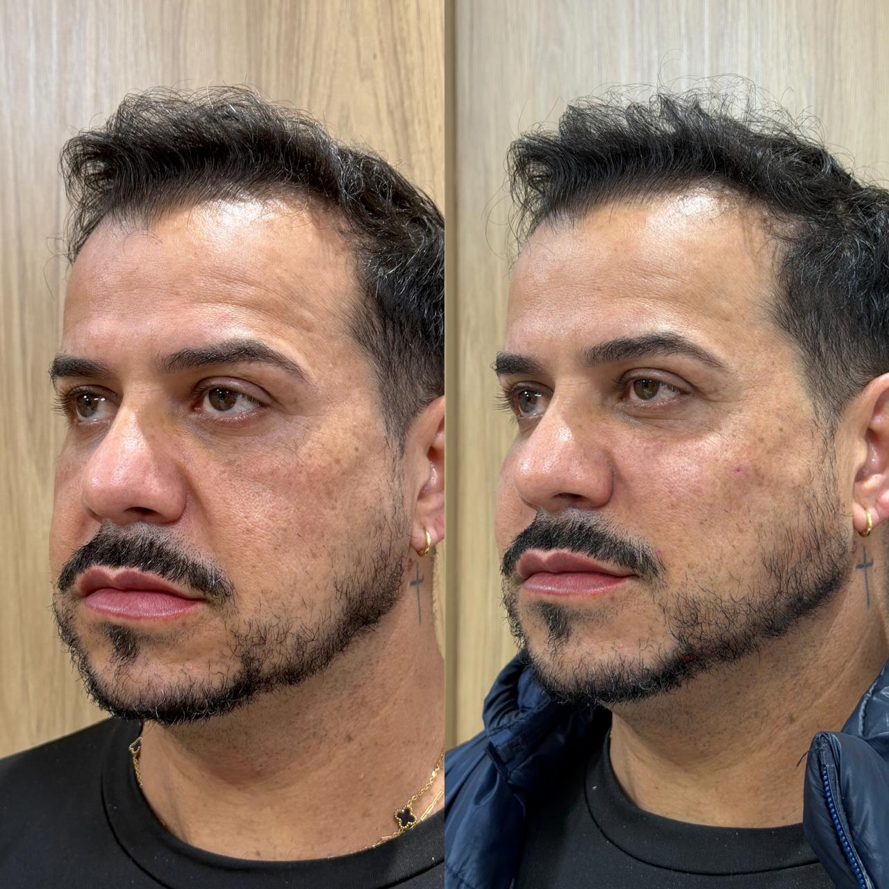 Caso selecionado em comparação antes e depois