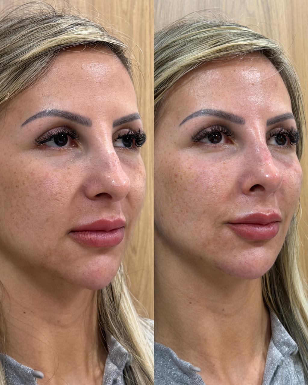 Caso selecionado em comparação antes e depois