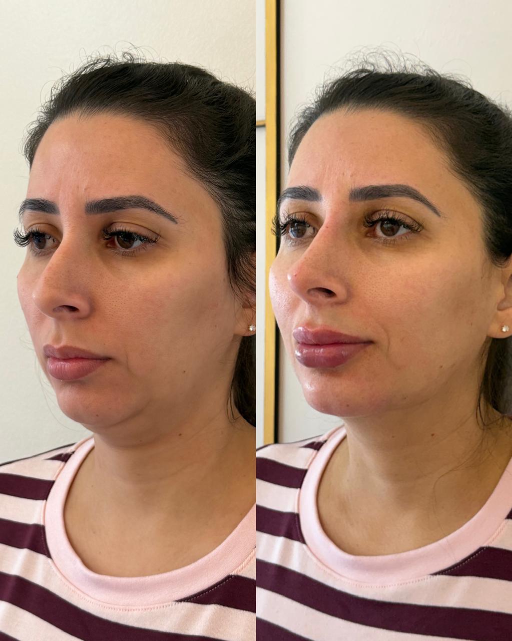 Caso selecionado em comparação antes e depois